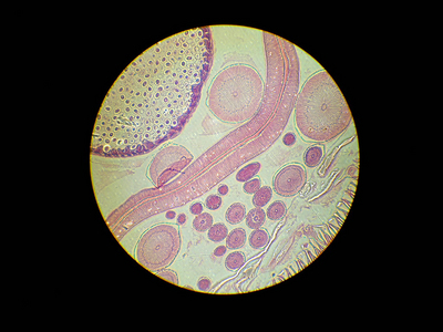 Pod mikroskopom 2
